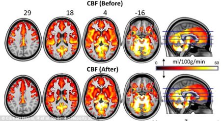 Mushrooms Can Reset Brains of Depressed Patients. Depression is the most common disease these days, and everybody faces a difficult situation in their life.