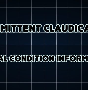Intermittent Claudication