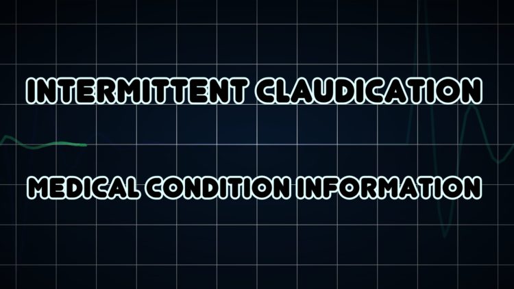 23 Intermittent Claudication