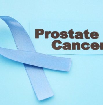 Prostate Cancer – Symptoms and Treatment Prostate Cancer - Symptoms and Treatment