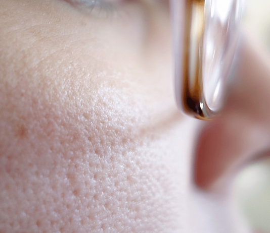 How to Get Rid off Enlarged Pores? The girls perfection may very well be the enlarged pores around the nose that deflect attention from the sweet nose and sparkling eyes.