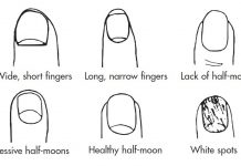 Fingers and Nails – Symptoms Indicate the Specific Conditions Fingers and Nails - Symptoms Indicate the Specific Conditions