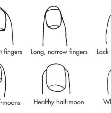 Fingers and Nails – Symptoms Indicate the Specific Conditions Fingers and Nails - Symptoms Indicate the Specific Conditions