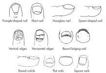 24 Misunderstood Facts About Nail Color, Shape, and Texture These are 24 most important Facts about Nail, and the following symptoms indicate the specific conditions of color, shape and teture of nails.