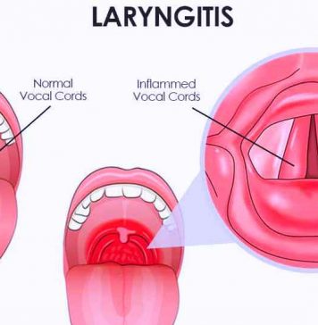 How to Treat Laryngitis? How to Treat Laryngitis? The lymphatic system should be focus of tonic support. And attention should be given to strengthening immune system.