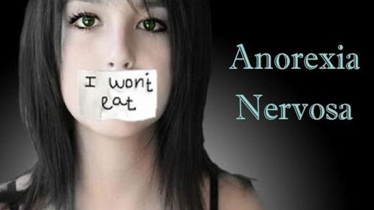 All the signs suggest that Anorexia Nervosa - epidemic throughout the Western world today-is yet another disease of our civilization.