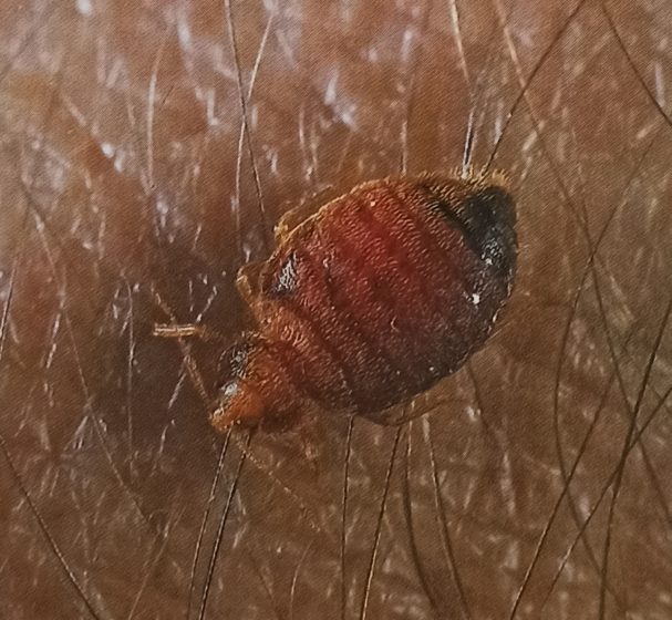 Modern hygiene has fortunately reduced the chances of coming across a bed bug in the house.