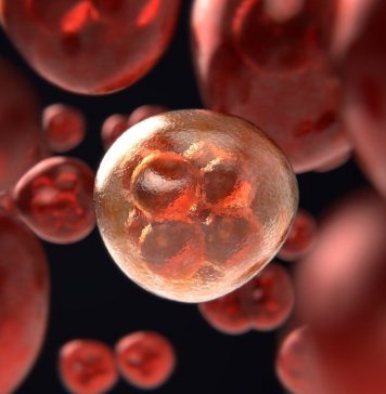 Cancer and Biopsy Cancer and Biopsy - The biopsy is essential for the final diagnosis of any type of cancer. Several methods of biopsy are used.