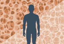 Osteoporosis – Building Strong Bones Osteoporosis is a common condition, affecting more than 24 million Americans, according to U.S. government figures.