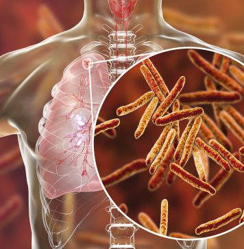 Is TB Curable Disease? Is TB Curable Disease? TB is a contagious disease and when a patient coughs. The TB bacteria in their mucus spread to other people through the air, thus making the other person a TB patient.
