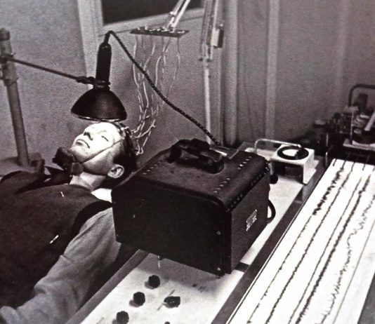 The Electroencephalogram – 1924