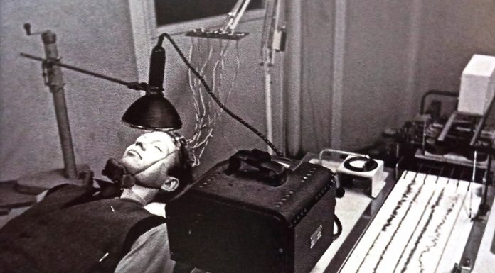 The Electroencephalogram – 1924