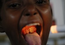 How is Diphtheria Controlled? Diphtheria is a serious disease. How is Diphtheria Controlled? It is caused by bacteria, and illness starts a few days after the bacteria enter the body.