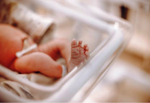 Things You Should Know When Filing Birth Injury Lawsuits Birth Injury Lawsuits - Did you know? More than 3 million children are born in the USA every year. Of those around 120,000 experience some birth injury.