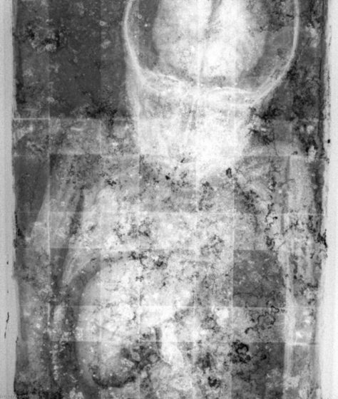 Rosalia Lombardo - The Blinking Mummy - The X-ray of Rosalia showing her brain and liver intact.