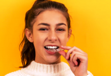 Simple Ways to Keep Your Teeth White Simple Ways to Keep Your Teeth White