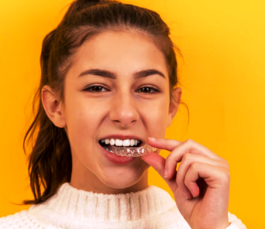 Simple Ways to Keep Your Teeth White Simple Ways to Keep Your Teeth White