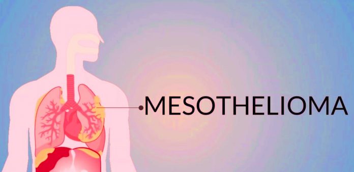 What are the most common complications of mesothelioma surgery?