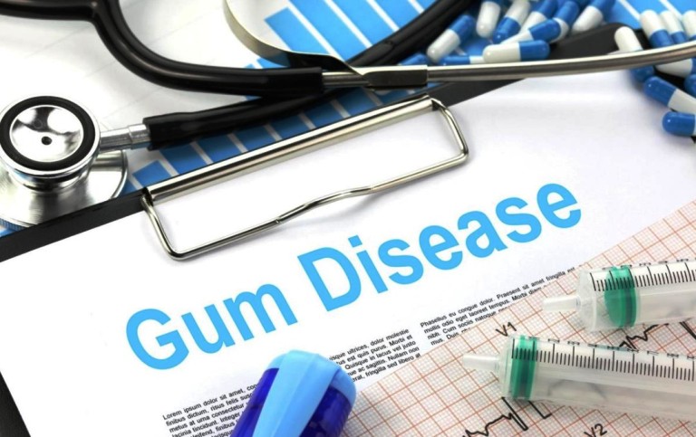 What are the causes of gum disease