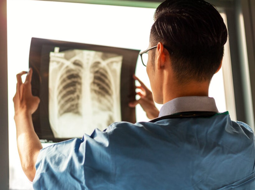 What is Staging in Mesothelioma