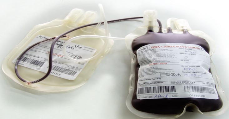 The Role of Blood Bag Labels in Transfusion Medicine The practice of transfusion medicine has become increasingly complex due to advances in modern medicine.
