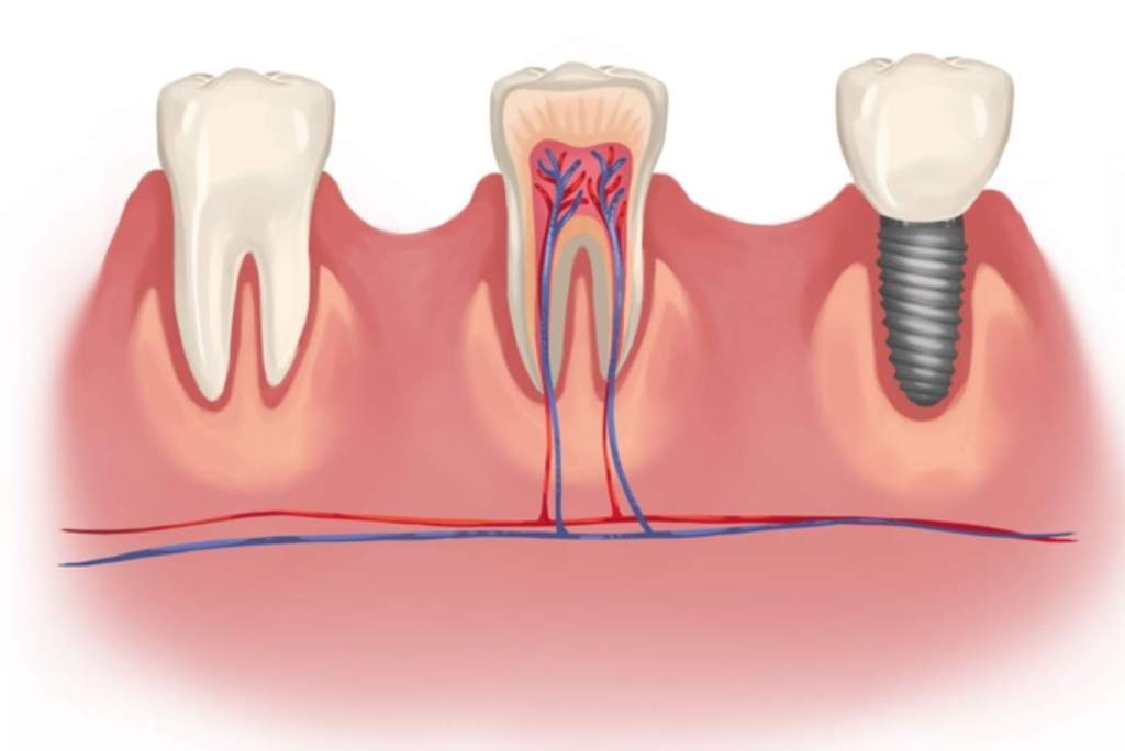 Advanced Gum Disease And Conventional Treatments